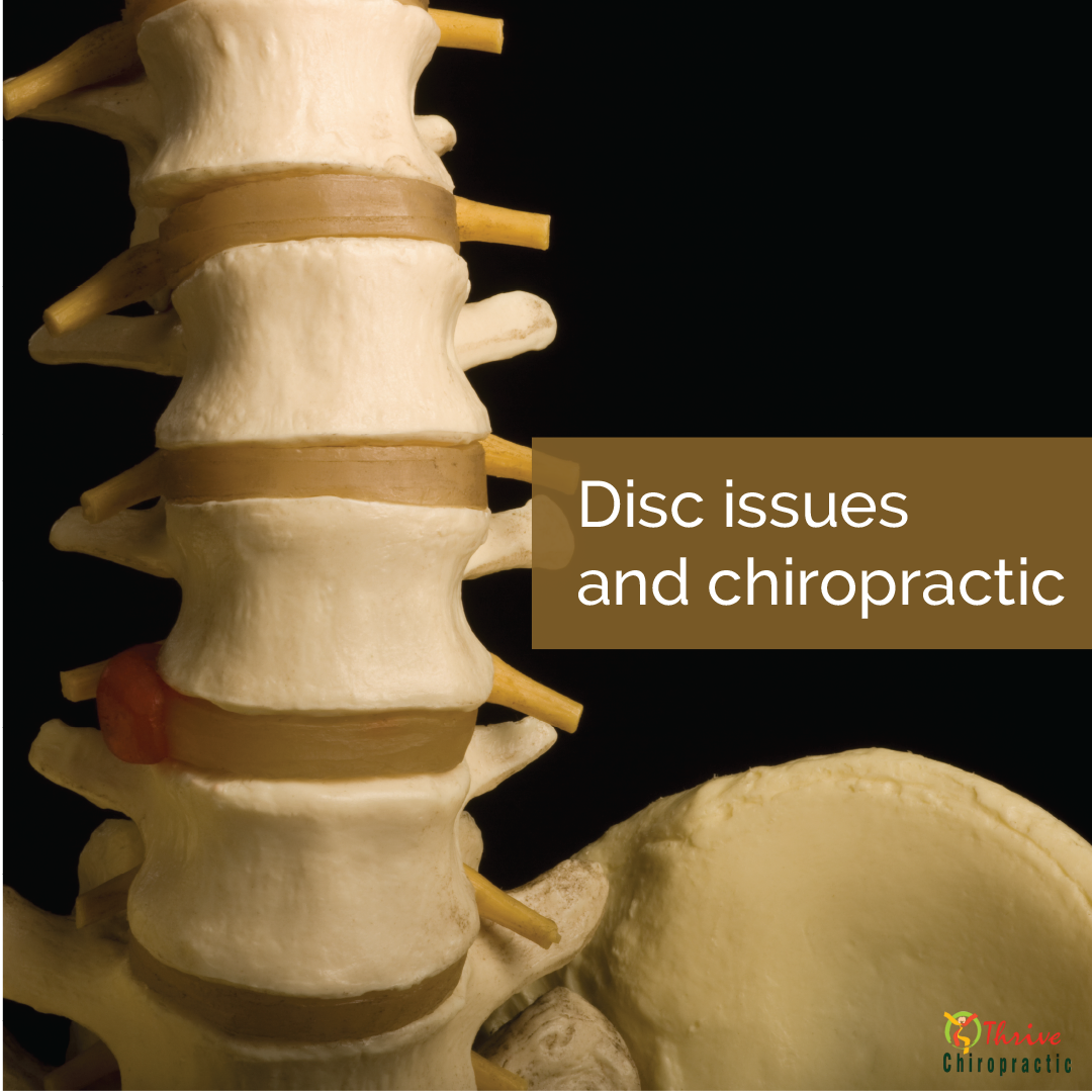 Spinal Disc Problems-What Your Doctor Doesn't Want You To Know